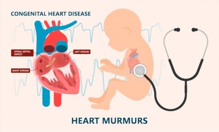 common-birth-defects-and-their-symptoms-beyah-fitness