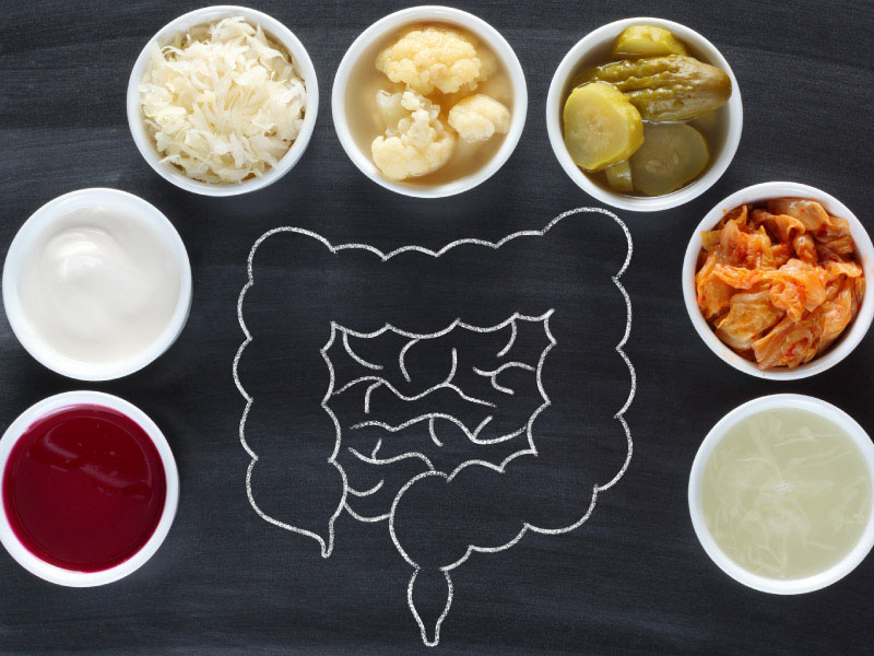 The Benefits of Fermented Foods and Their Impact on Gut Health